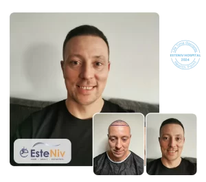 Esteniv - وجهتك المثلى لزراعة الشعر وتجميل الأسنان